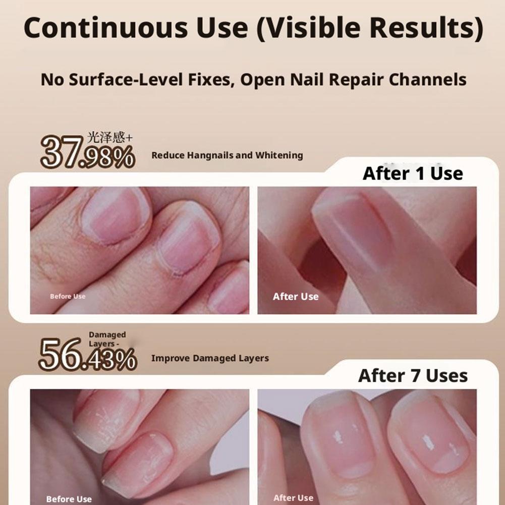 Cuticle Oil Pen - Nails 3-in-1 Cuticle Oil Pen with